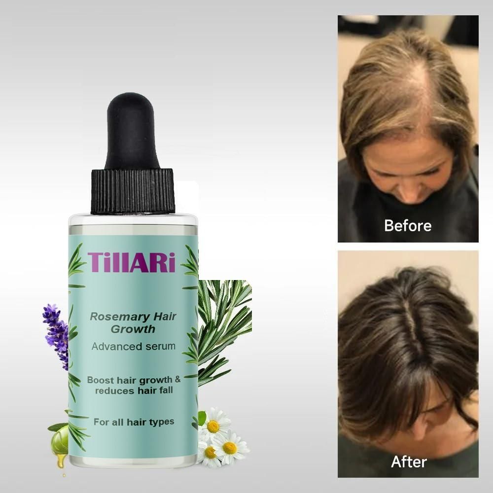 Tillari Rosemary Hair Growth Serum - Velora