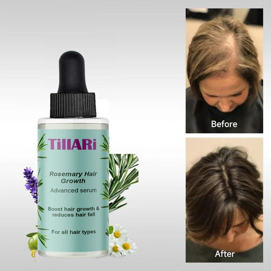 Tillari Rosemary Hair Growth Serum - Velora