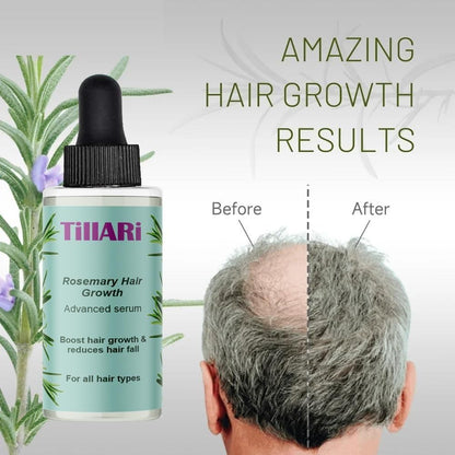 Tillari Rosemary Hair Growth Serum - Velora